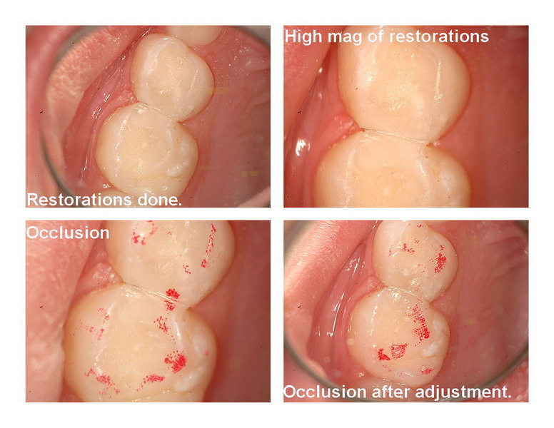 Kiss caries pg 4_resize.jpg